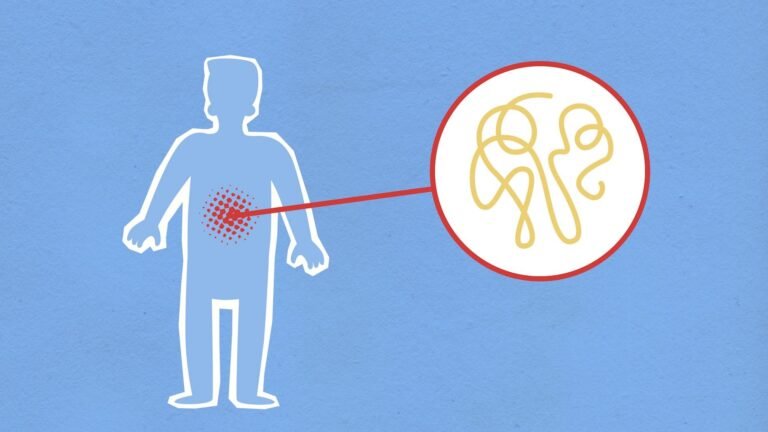 Ebola : mesures frontalières temporaires en vigueur dès le 27 mai 2026 au Canada